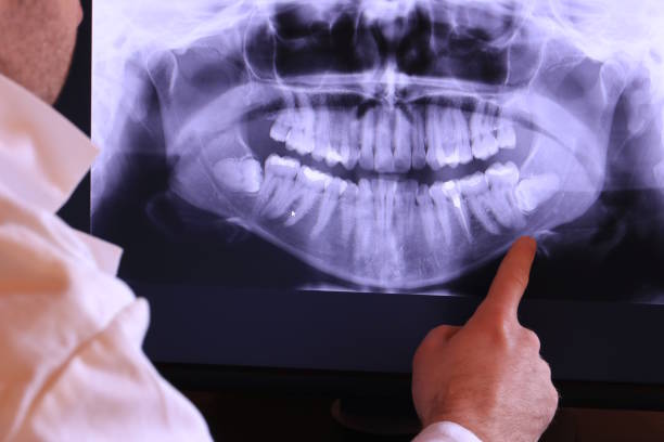 Best Knocked-Out Tooth Emergency  in Nowata, OK