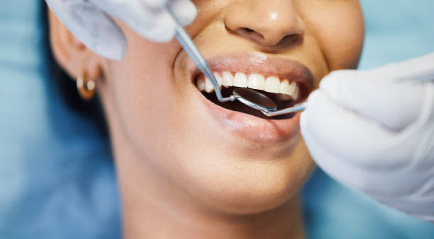 Best Chipped Tooth Repair Near Me  in Nowata, OK