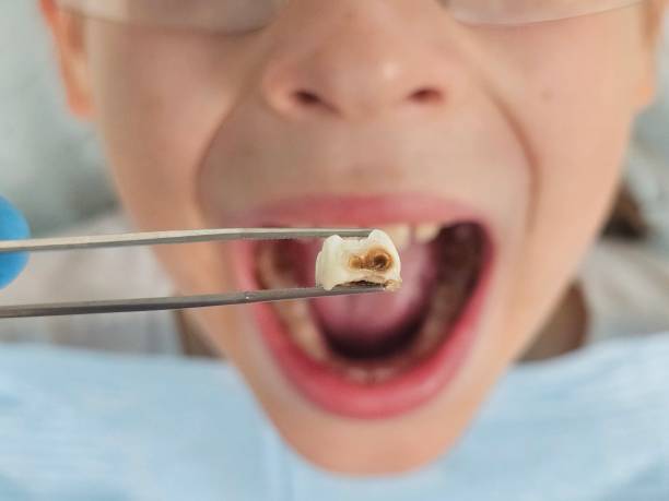 Best Knocked-Out Tooth Emergency  in Nowata, OK